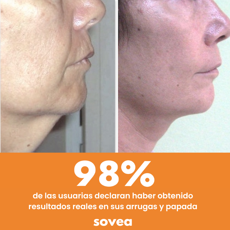 Dispositivo EMS - Rejuvenecimiento Facial y del Cuello